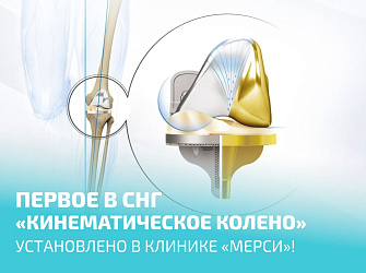 Первый в СНГ эндопротез с кинематическим позиционированием компонентов.